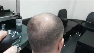 پودر پرپشت کننده مو+حجم دهنده مو لوییس بین