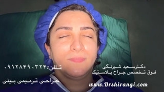 جراحی بینی برای چه سنی بهتر است؟