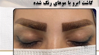 کاشت ابرو با موهای رنگ شده