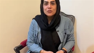 کاشت ابرو