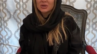 کاشت ابرو