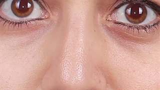 عمل بینی سوپر نچرال