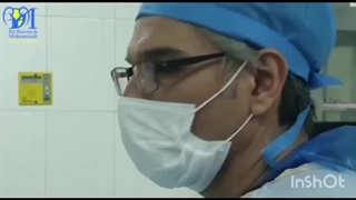 خرد کردن سنگ مثانه بزرگ