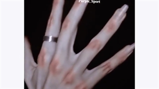 انگشتای لاغری داشته باش ⁦<⁠(⁠￣⁠︶⁠￣⁠)⁠>⁩درخواستی