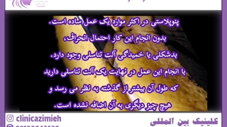 پنو پلاستی
