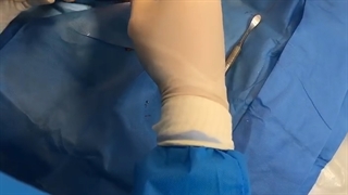 بدون درد ایمپلنت کنید با دکتر الیاهو