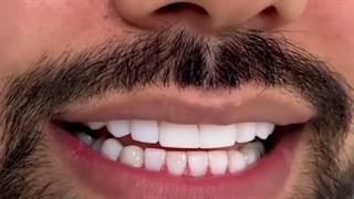 شانزده واحد ونیر کامپوزیت