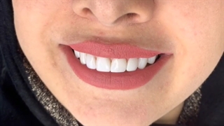 هشت واحد ونیر کامپوزیت