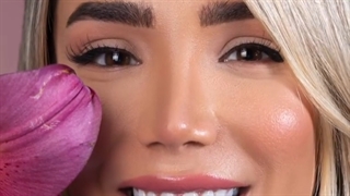 لمینت سرامیکی دندان