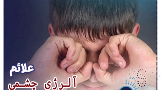 علائم آلرژی چشمی