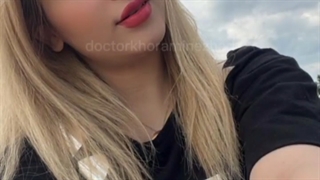 عکس ارسالی زیباجوی عزیزمون و رضایتمندی از جراحی زیبایی بینی