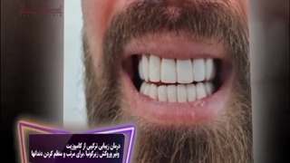 درمان زیبایی ترکیبی از کامپوزیت ونیر وروکش زیرکونیا ،برای مرتب و منظم کردن دندانها