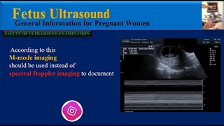 بی خطر بودن سونوگرافی در بارداری ⚪️