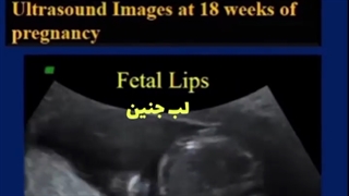 بچه هایی که دوباره به کلینیک ما مراجعه می کنند