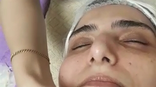 ماساژصورت عالی ترین روش خونرسانی در فیشیال پوست بلیچینگ دندان