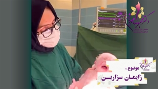 زایمان سزارین قسمت 2