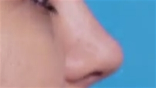 جراحی بینی به این نچرالی دیده بودین؟!