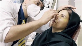 جراحی بینی سبک مدرن