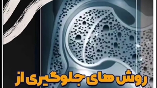 روش های جلوگیری از تخریب استخوان ها⭕