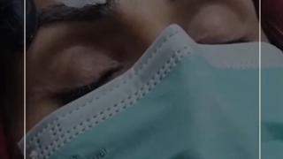 فوائد مزوتراپی ابرو