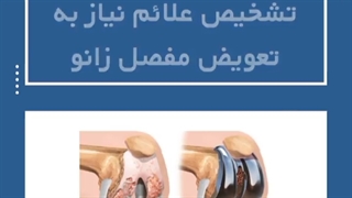 تشخیص علائم نیاز به تعویض مفصل زانو