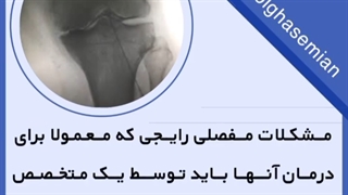 مشکلات مفصلی رایج