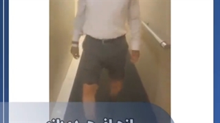 انحراف هر دو زانو بیمار عزیز بعد از جراحی رفع انحراف زانو راست