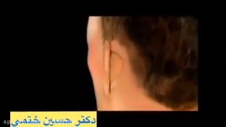 اتوپلاستی(جراحی زیبایی گوش)