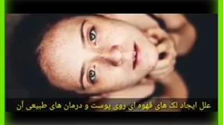 سریعترین راه از بین بردن لک صورت چیست؟ منافذ باز پوست