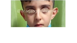 اتوپلاستی (جراحی زیبایی گوش)