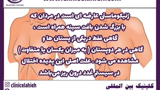 ژنیکوماستی