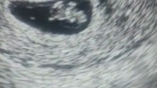 قشنگترین حس دنیا