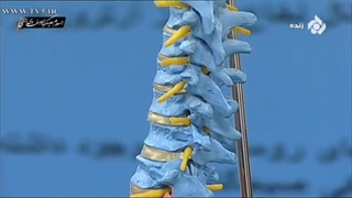 دکتر سید شهاب قاضی میر سعید جراح مغز و اعصاب در مورد دیسک گردن صحبت می کند اندودنتیکس