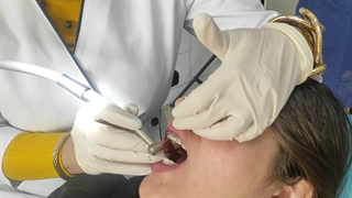 فیلم ارتودنسی دندان