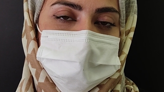 عمل بلفاروپلاستی پلک بالا