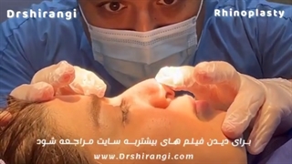 تغییر شکل بینی با کمترین عوارض توسط بهترین جراح بینی