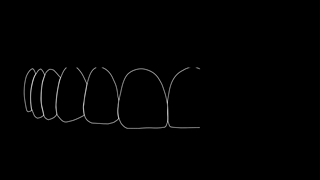 ایمپلنت فول فک بالا