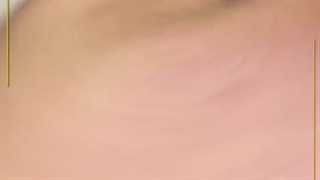 حجم و مدل سازی چانه