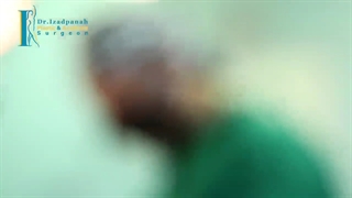 ابدومینوپلاستی