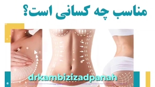 عمل لیفت بدن