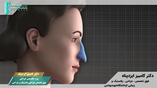روند جراحی بینی چگونه است؟ .