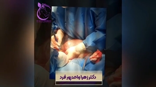 خروج توده ۲۵ سانتی از شکم خانم جوان