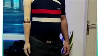 پروتز زیبایی بالای آرنج-کلینیک ارتوپدی فنی حکیم