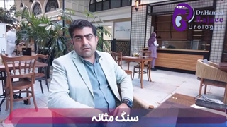 عوارض سنگ مثانه