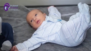 ختنه نوزادان