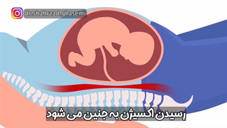 آموزش نحوه درست خوابیدن در بارداری