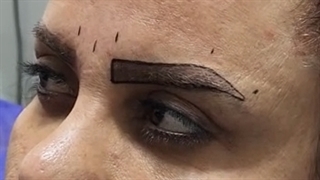 کلینیک کاشت ابرو با لیزر در تهران باکادری مجرب و محیطی آرام