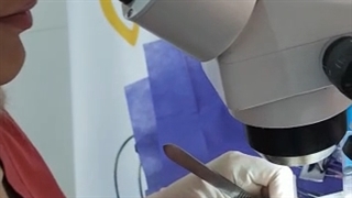 کلینیک کاشت ابرو با لیزر در تهران باکادری مجرب و محیطی آرام