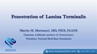 جراحی فنستره کردن لامینا ترمینالیس