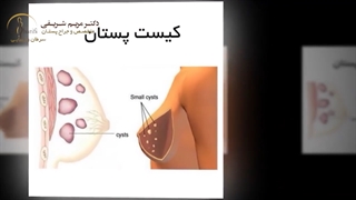 جواب سونوگرافی